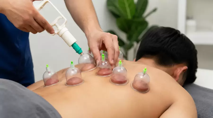 Cupping Therapy Cupping Therapy
