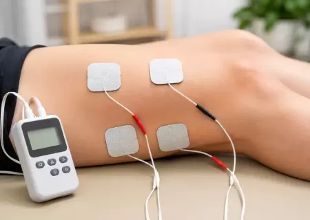 Transcutaneous Electrical Nerve Stimulation (TENS) Therapy